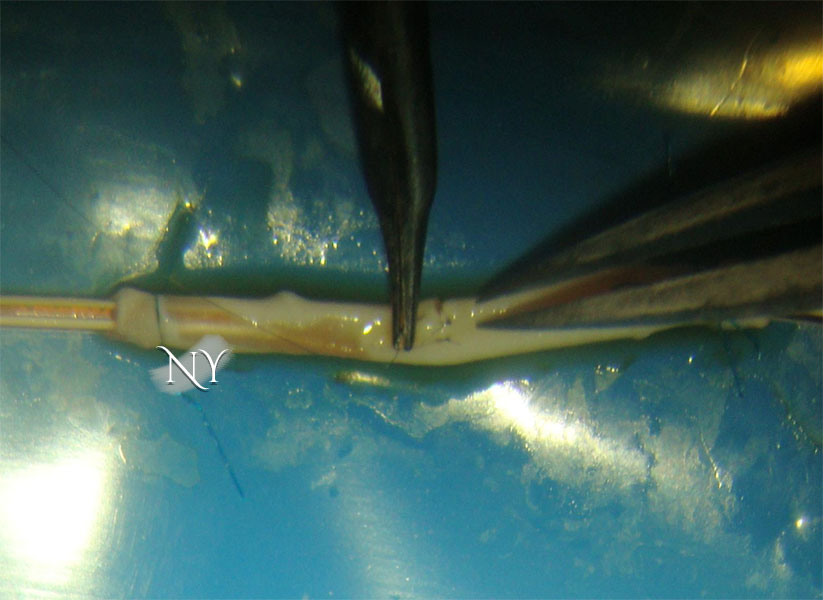 Bir damar simülatöründe saç telinden ince dikişlerle yapılan bir damar onarım çalışması